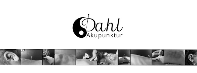 Anmeldelser af Dahl Akupunktur i Randers - Akupunkturklinik