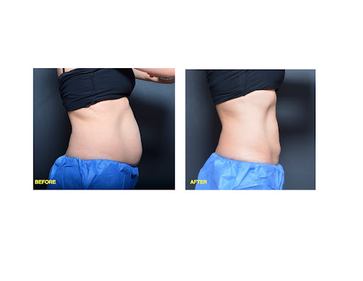 Explore tattoo sleeve ideas for guys, creative tattoo ideas in Chino, available at SoCal Body Institute