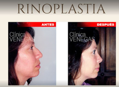 Cirugia Estetica Venegas - Cirugia Estetica Venegas