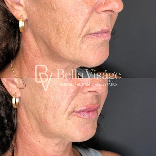 Find friendship tattoos ideas for your next unique tattoo in Lakeland at Bella Visge Medical & Aesthetic Rejuvenation