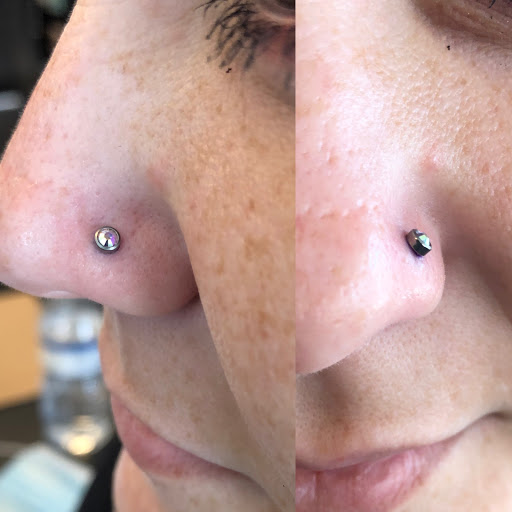 Explore tattoo scar cover up ideas, creative tattoo ideas in Palm Harbor, available at Angry Owl Tattoo and Piercing