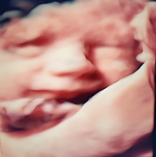 Baby Wave 4D Ultrasound image