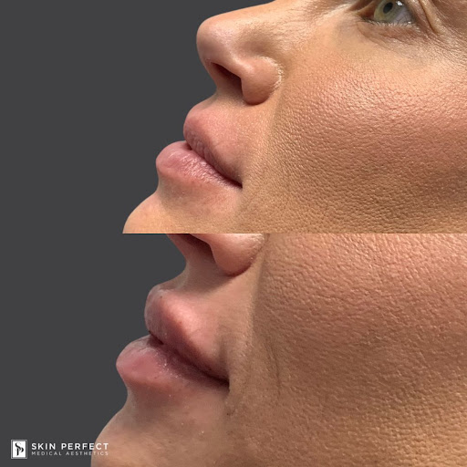 Explore middle neck tattoo ideas, creative tattoo ideas in Whittier, available at Skin Perfect Medical Aesthetics