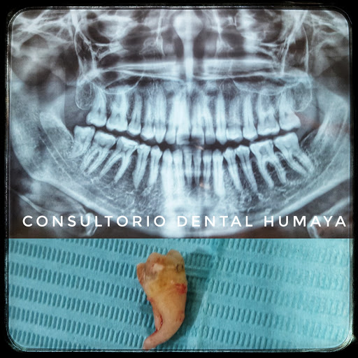Consultorio Dental Humaya En Culiacan, Dentista Dr. Yusseff O. Rivera