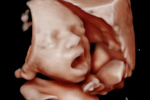 Hi Baby Ultrasound El Cajon image