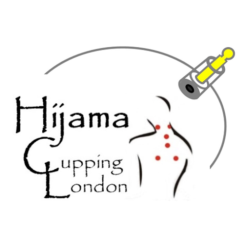 Hijama Cupping London E17 - London