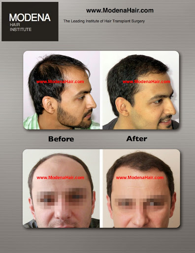 Modena Hair Transplant Institute image