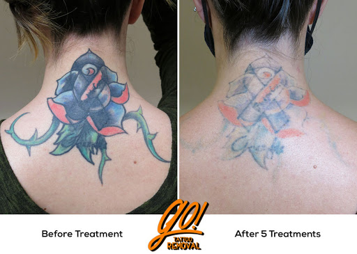 Explore three sibling tattoo ideas, creative tattoo ideas in Allentown, available at Removery Tattoo Removal & Fading