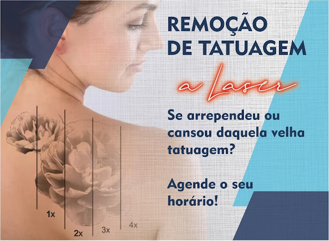 Lorenzo Tatuador e Remoção de Tatuagem a Laser - Lisboa