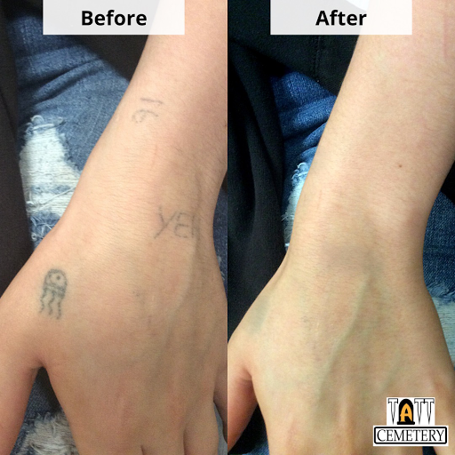 Explore men side neck cover up tattoo ideas, creative tattoo ideas in Fort Myers, available at Laser Tattoo Removal by Tatt Cemetery