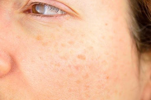 West Dermatology Redlands image