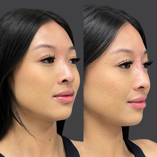 Explore nintendo tattoo ideas, creative tattoo ideas in Whittier, available at Skin Perfect Medical Aesthetics