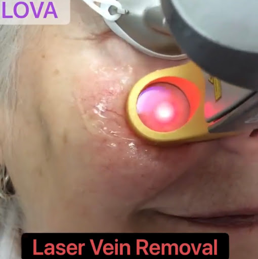 Explore three sibling tattoo ideas, creative tattoo ideas in Lake Oswego, available at Lake Oswego Vein and Aesthetic LOVA