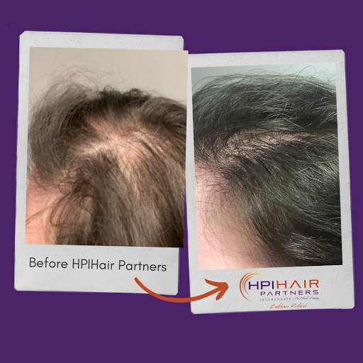 Hair Replacement Service «HPI Hair Partners», reviews and photos, 4535 Harding Pike #302, Nashville, TN 37205, USA