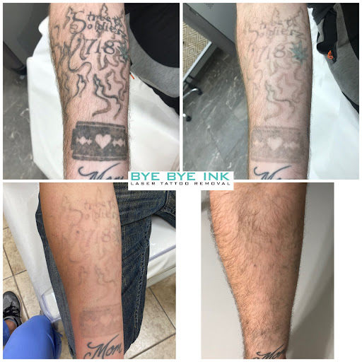 Explore cute dinosaur tattoo ideas, creative tattoo ideas in Middle Village, available at Bye Bye Ink Laser Tattoo Removal