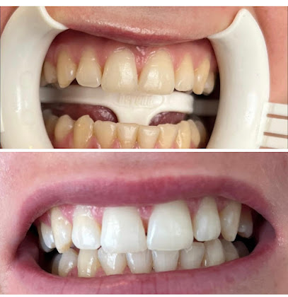 The Teeth Whitening Lab - Christchurch Former Dental Therapist