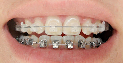 Dr Rachid DHIMANE - Chirurgien-dentiste - pratique de l'orthodontie proche de Valenciennes à Bruay-sur-l'Escaut