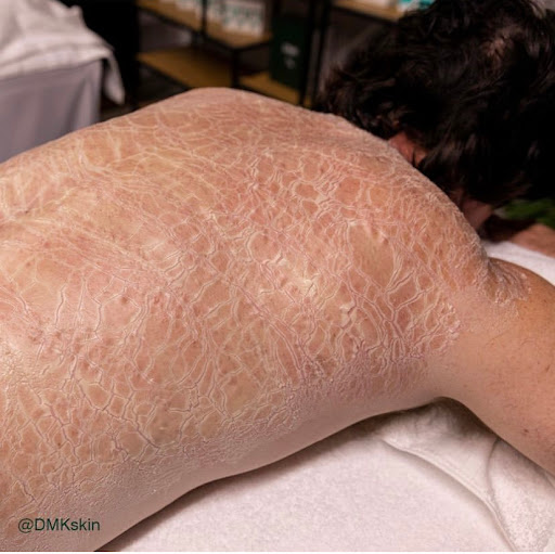 Evolutionary Skin Co image