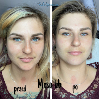 سكينعيادة - Warszawa Mokotow - SkinClinic - Warszawa Mokotow