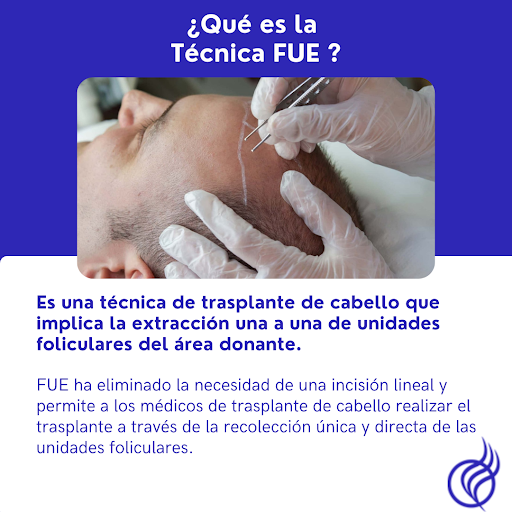 Trasplante de Cabello en Naucalpan - Dr. Luis Gabriel Esquivel