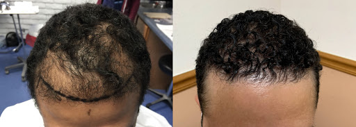 Hair Replacement Service «Tampa Bay Hair Restoration», reviews and photos, 1266 Turner St b, Clearwater, FL 33756, USA