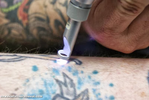 Explore cool name tattoo ideas, creative tattoo ideas in Swansea, available at NewSkin Laser Tattoo Removal