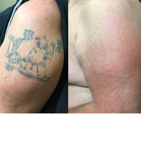 Explore good and bad tattoo ideas, creative tattoo ideas in Omaha, available at Enlighten Omaha