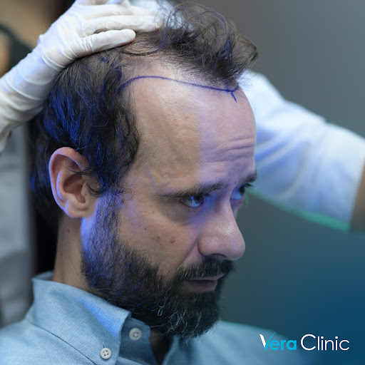 Vera Clinic - Kartal polikliniği | Hair Transplant Clinic in Turkey
