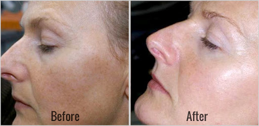 Explore thor's hammer tattoo ideas, creative tattoo ideas in Tucson, available at Allure Medical