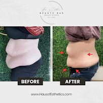 Haus of Esthetics Beauty Bar (Appointment Only) - Photo 6 - Car repair in Iowa City, IA, Iowa City