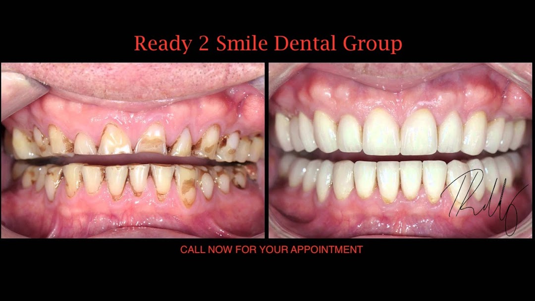 Ready 2 Smile Dental Group