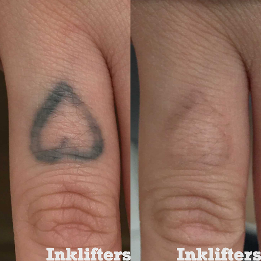 Explore tattoo ideas for name cover up, creative tattoo ideas in Pleasant Grove, available at Inklifters Tattoo Removal