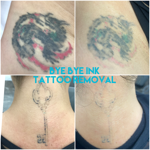 Explore name cover up tattoo ideas male, creative tattoo ideas in Middle Village, available at Bye Bye Ink Laser Tattoo Removal