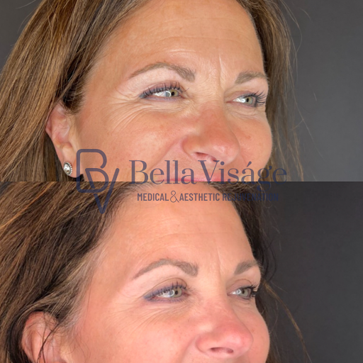 Explore lil peep tattoo ideas, creative tattoo ideas in Lakeland, available at Bella Visge Medical & Aesthetic Rejuvenation