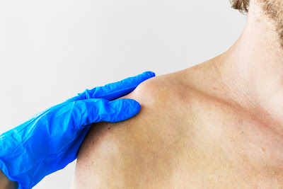 Docteur SFEZ - chirurgien orthopédiste à Tremblay-en-France