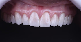 Instituto Jarede - Odontologia e Saúde ( Implantes Dentários e Lentes de Contato )