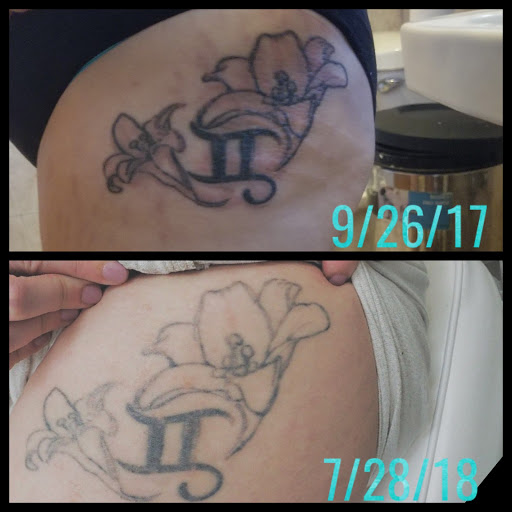 Explore new tattoo ideas, creative tattoo ideas in Middle Village, available at Bye Bye Ink Laser Tattoo Removal