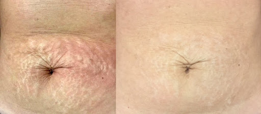 Laser Hair Removal Service «All Care Laser Center», reviews and photos, 820 Turnpike St, North Andover, MA 01845, USA