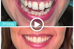 Studio Dentistico Scorca INVISALIGN | Dentista Bari | Sbiancamento | Impianti Dentali | Apparecchio Invisibile image