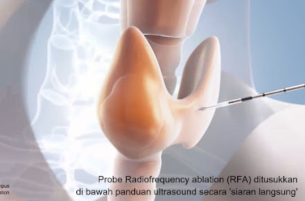 Vincent ENT, Thyroid, Head & Neck Surgery Specialist Clinic - Vincent ENT, Thyroid, Head & Neck Surgery Specialist Clinic