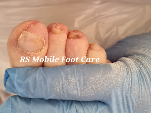 RS Mobile Foot Care