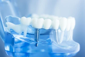 Montague Hills Dentistry image