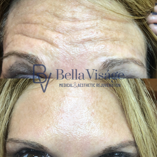 Explore stopwatch tattoo ideas, creative tattoo ideas in Lakeland, available at Bella Visge Medical & Aesthetic Rejuvenation