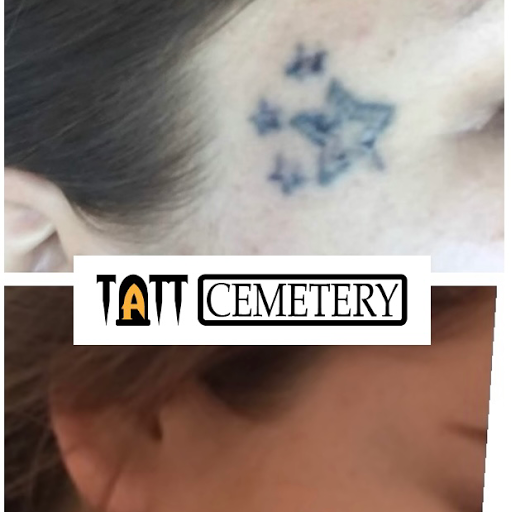 Explore hearts tattoo ideas, creative tattoo ideas in Fort Myers, available at Laser Tattoo Removal by Tatt Cemetery
