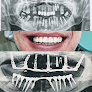 Dental implantology courses Minsk