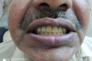 Sanjeevani Dental Care - Dentist | RCT | Braces | Dental Implants | Sector 3/CGHS/DGEHS/DDA/DELHI UNIVERSITY Rohini image