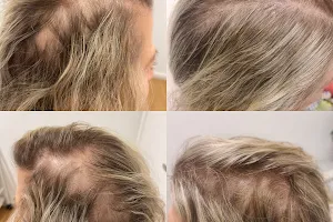Deluxe Clinic Hair Regrowth Skin & Laser image