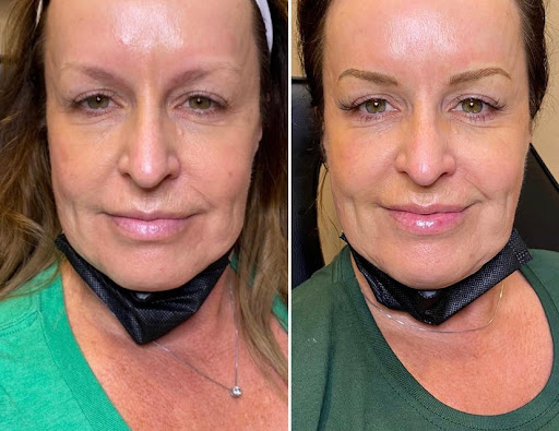 Find boyfriend name tattoo under breast ideas for your next unique tattoo in Santa Cruz at Luca Permanent Cosmetics