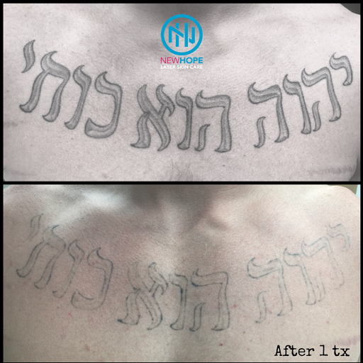 Explore from blood and ash tattoo ideas, creative tattoo ideas in Westminster, available at Newhope Laser Skin Care