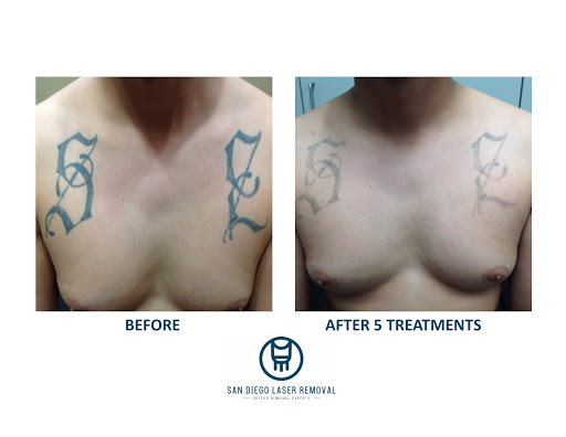 Explore tattoo ideas for men lower arm, creative tattoo ideas in San Diego, available at Removery Tattoo Removal & Fading